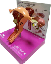 Medical Model
