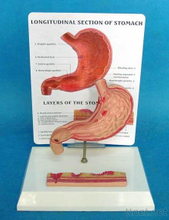 Medical Stomach Model