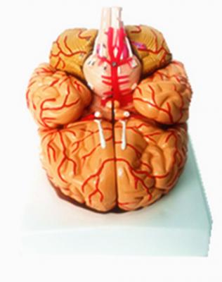 3D Medical Brain Mould
